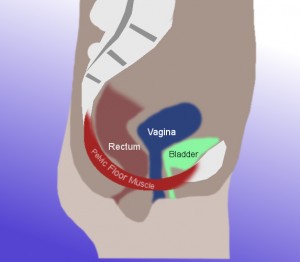 Vaginoplasty vs. LVR - Clear Sky Medical